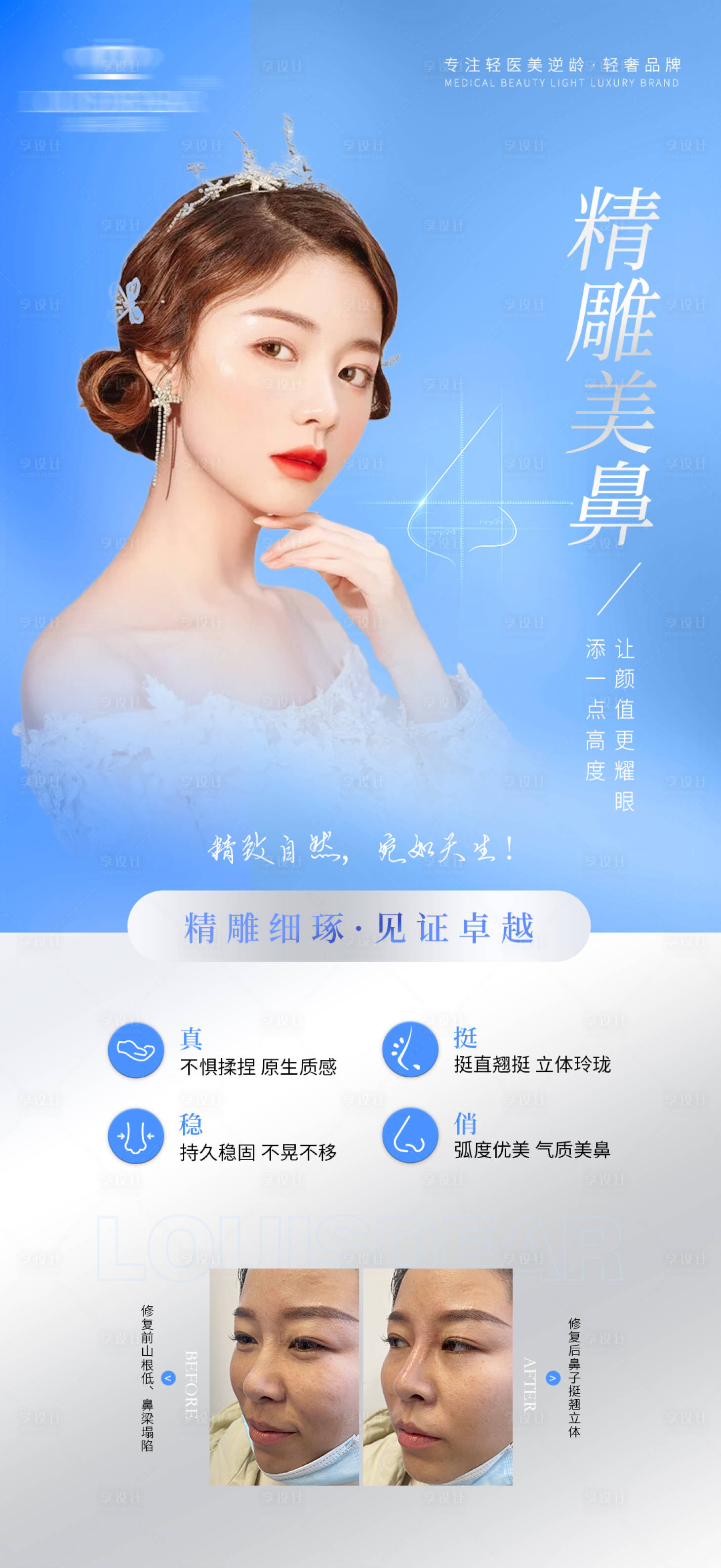 源文件下載【享設(shè)計】搜索編號：46530009635863778【鼻子整形海報】