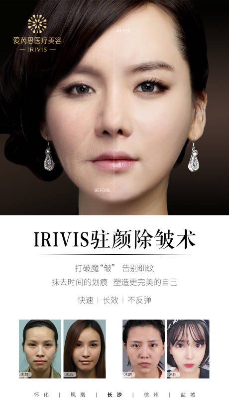 源文件下载【医美除皱抗衰简约海报】编号：44880009395834774