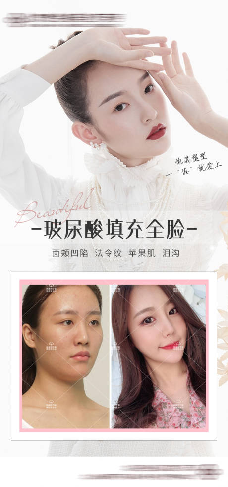 源文件下載【醫美案例對比】編號：27000009513243301