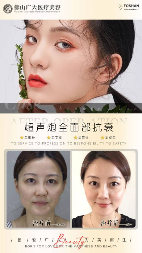 源文件下载【医美超声炮全面部抗衰海报】编号：43320009595594708