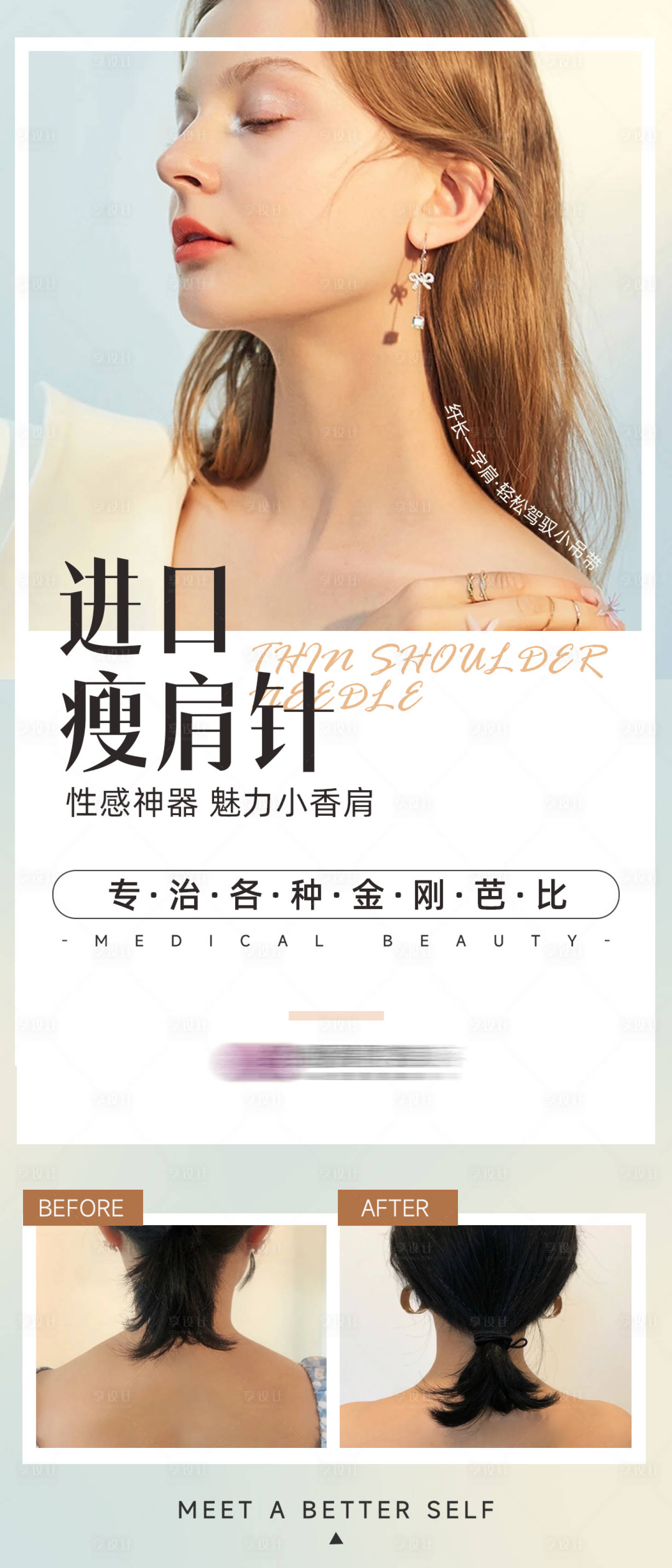 源文件下载【医美瘦肩针海报】编号：99080009433918734