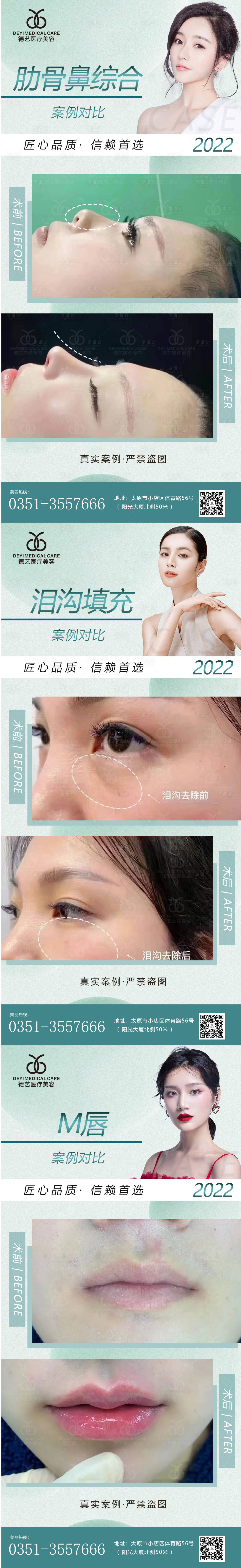 源文件下載【享設計】搜索編號：82400010203657202【醫美案例對比填充系列海報】