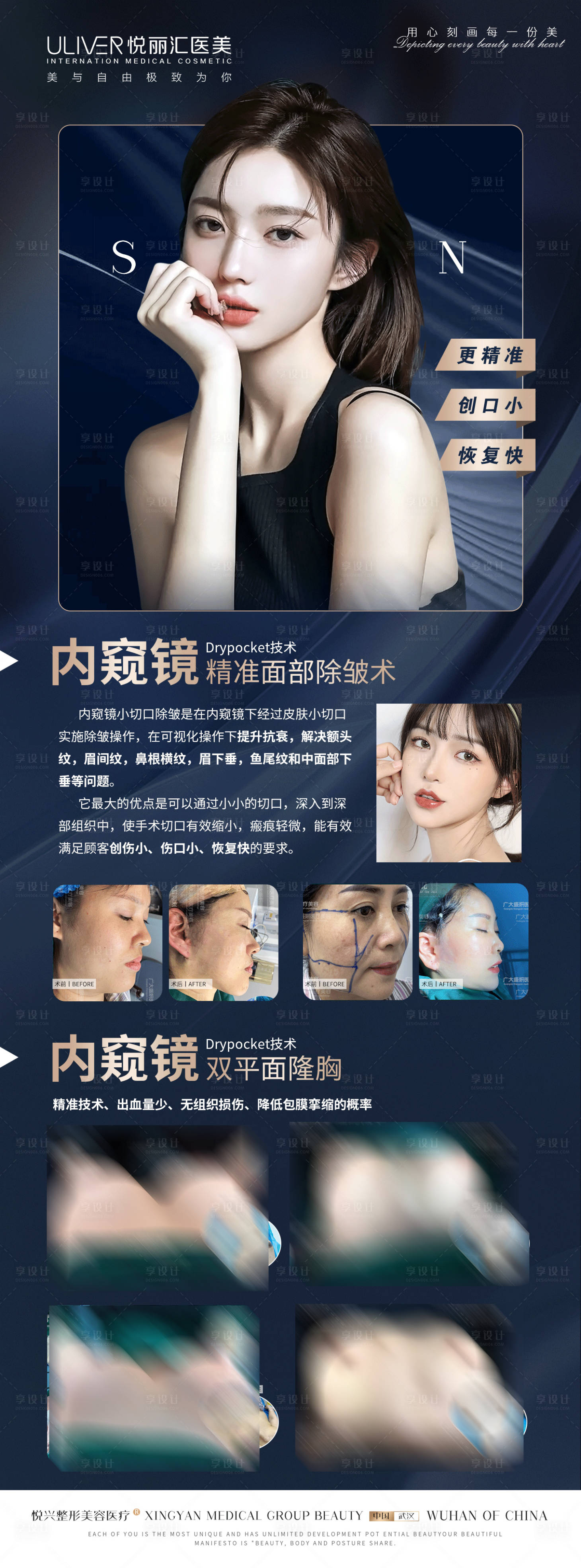 源文件下载【享设计】搜索编号：98540010040036501【医美内窥镜丰面部胸部简约海报】