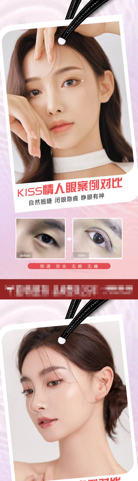 源文件下载【医美整形案例对比海报】编号：25560009926125594