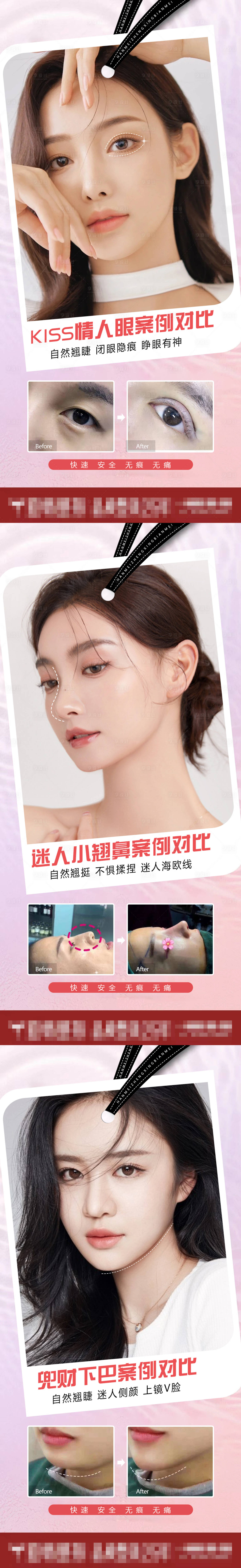 源文件下载【享设计】搜索编号：25560009926125594【医美整形案例对比海报】