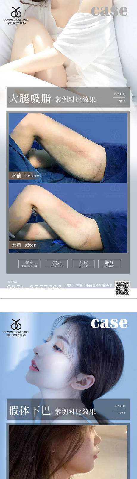 源文件下載【享設計】搜索編號：59420009959738718【醫美案例對比圖】