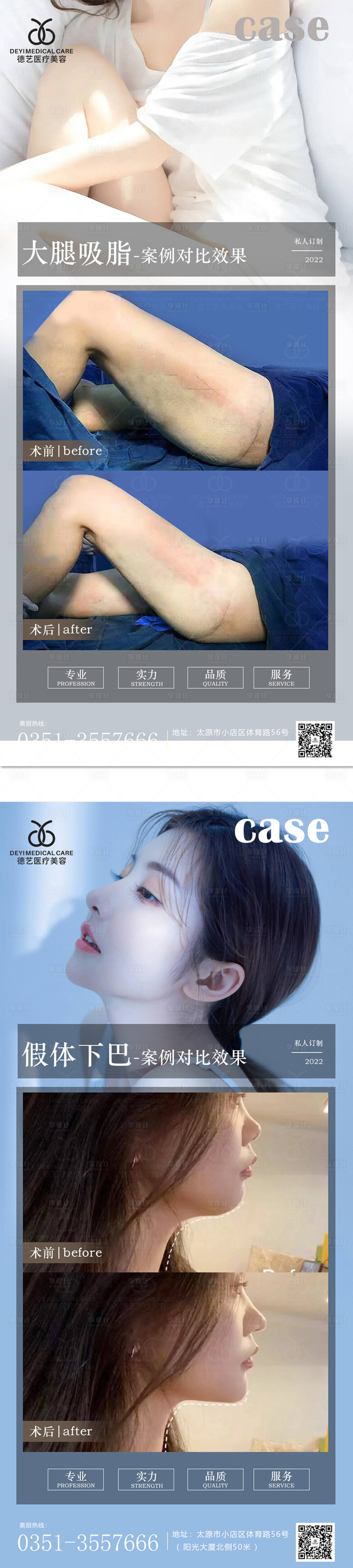 源文件下載【享設計】搜索編號：59420009959738718【醫美案例對比圖】
