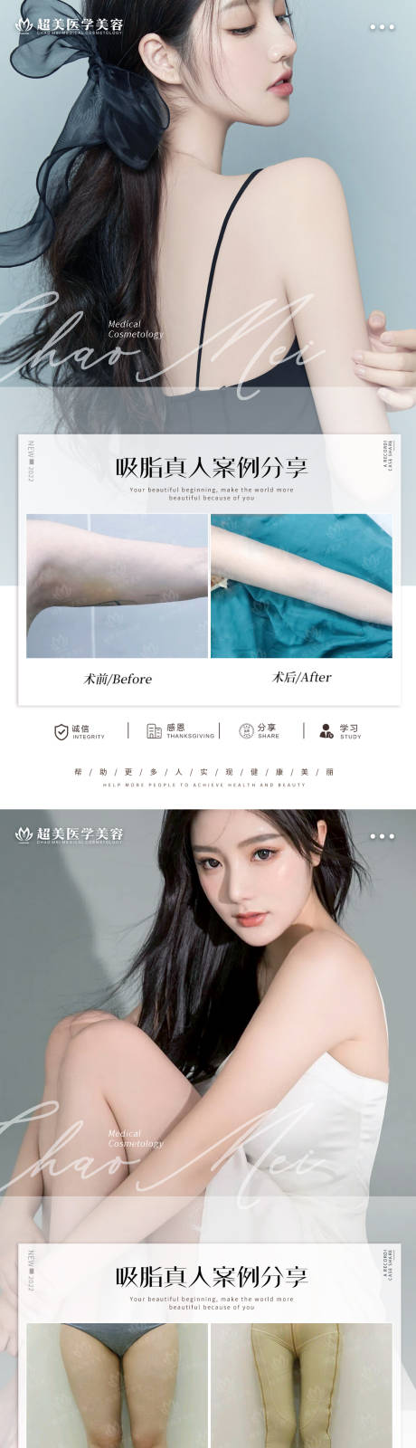 源文件下載【享設計】搜索編號：32890009987797084【吸脂案例對比海報】