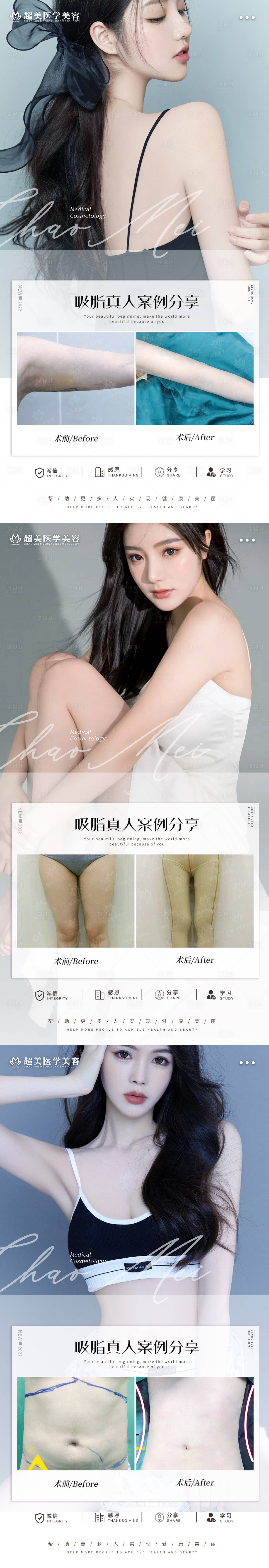 源文件下載【享設計】搜索編號：32890009987797084【吸脂案例對比海報】