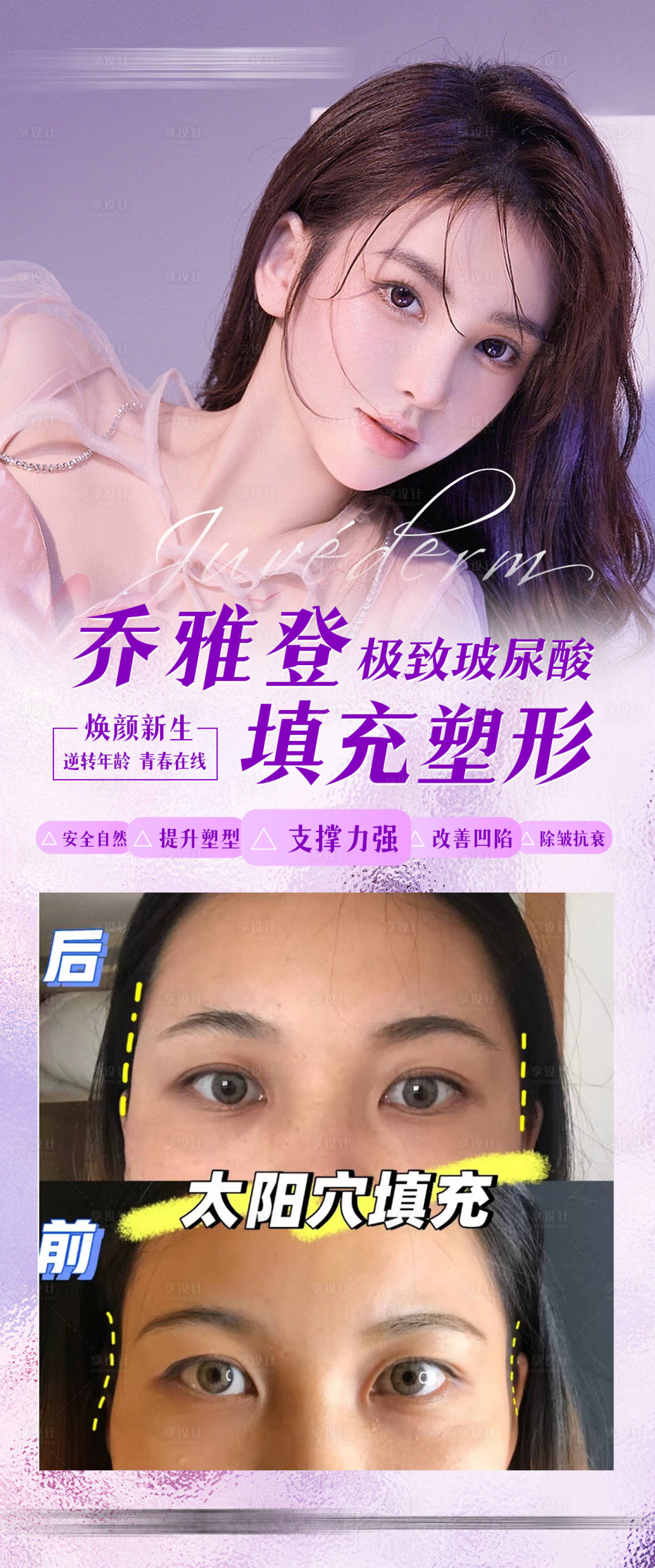 源文件下载【享设计】搜索编号：81630009955684018【医美案例对比】
