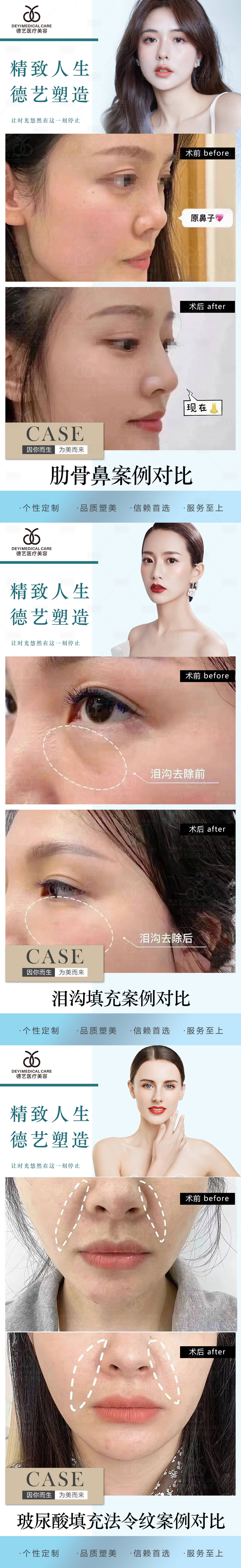源文件下載【享設計】搜索編號：63730010157612264【醫美案例對比圖】