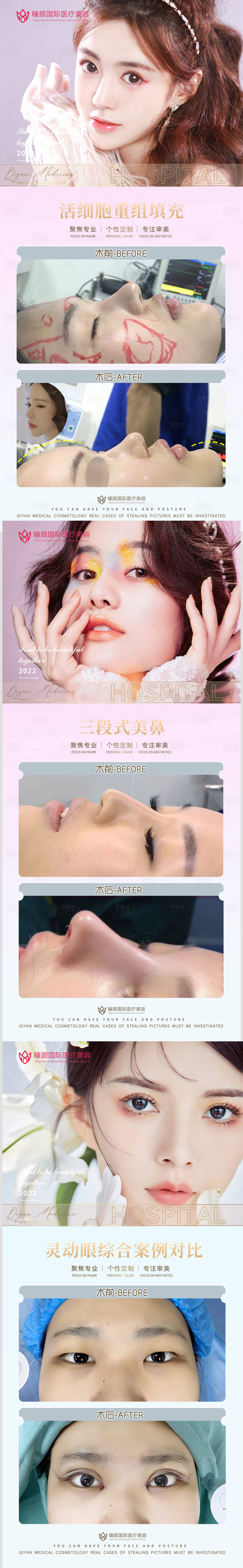 源文件下载【医美案例对比】编号：63410009800948150