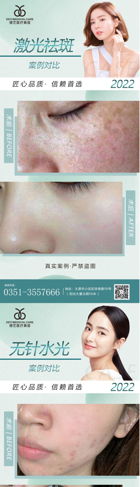 源文件下载【医美案例对比图】编号：86590010213213859