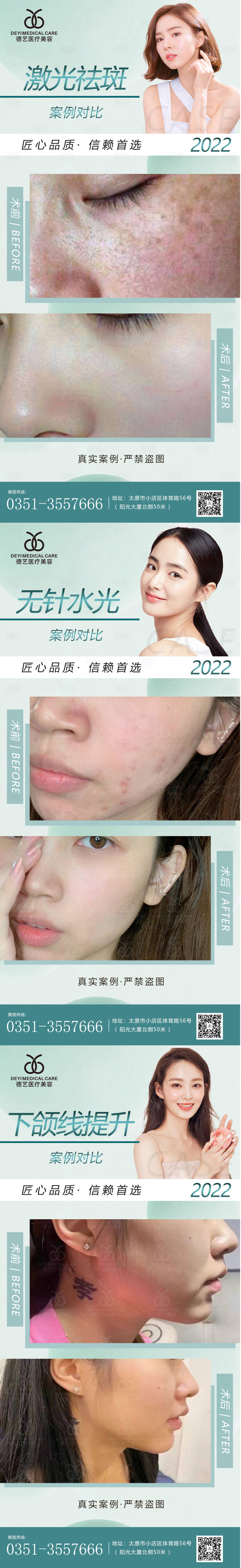 源文件下载【享设计】搜索编号：86590010213213859【医美案例对比图】