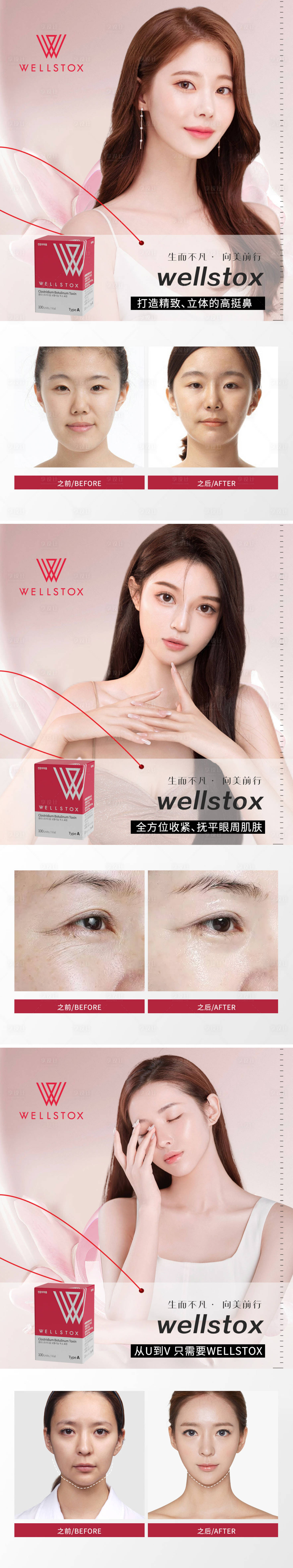 源文件下載【享設計】搜索編號：62970010078361912【肉毒素案例對比】