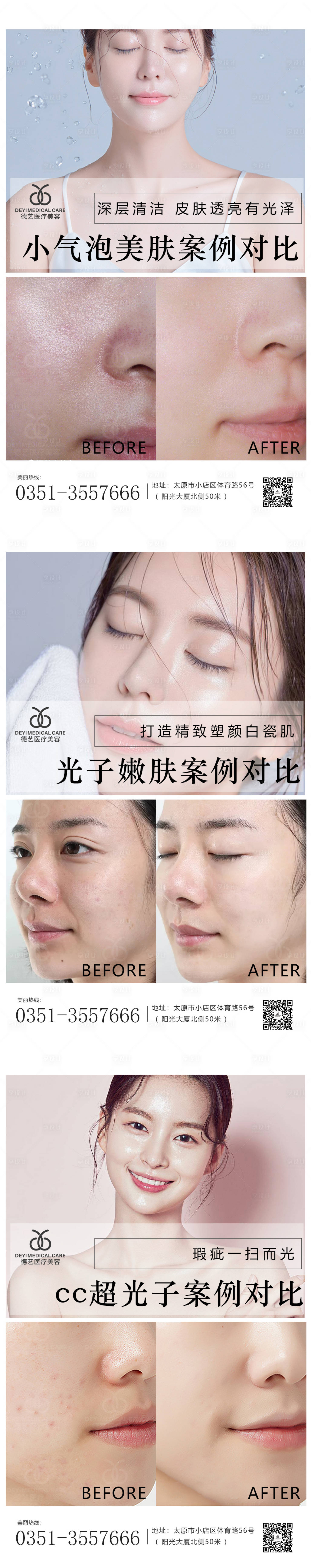 源文件下載【享設計】搜索編號：52830010296574424【醫美案例對比人物系列海報】
