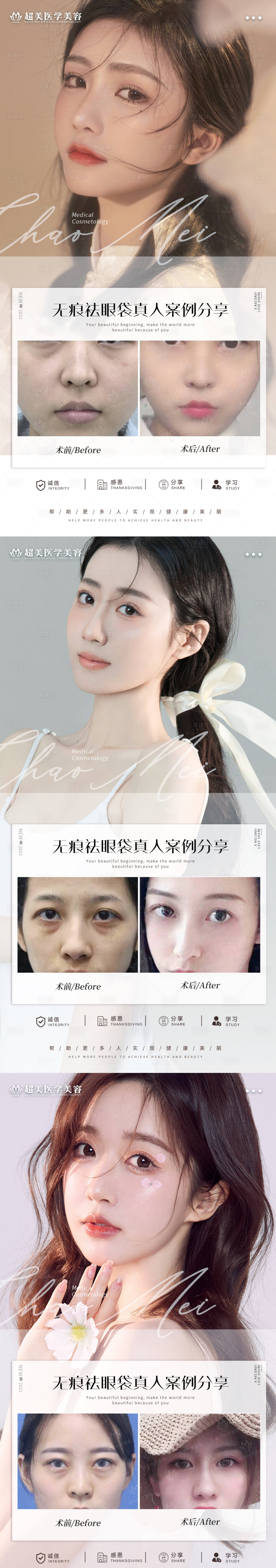 源文件下载【享设计】搜索编号：27680010003745936【祛眼袋案例(TIF用PS打开)】