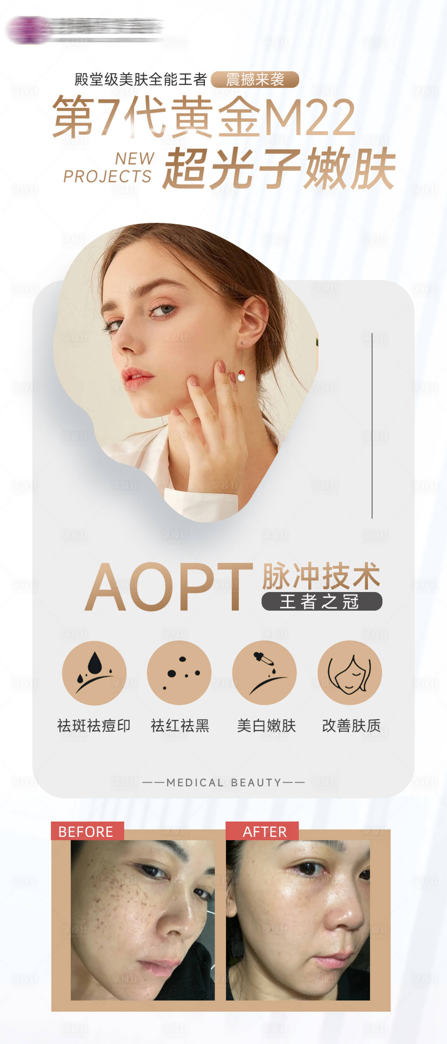 源文件下載【享設(shè)計(jì)】搜索編號(hào)：15410010063885255【醫(yī)美海報(bào)】