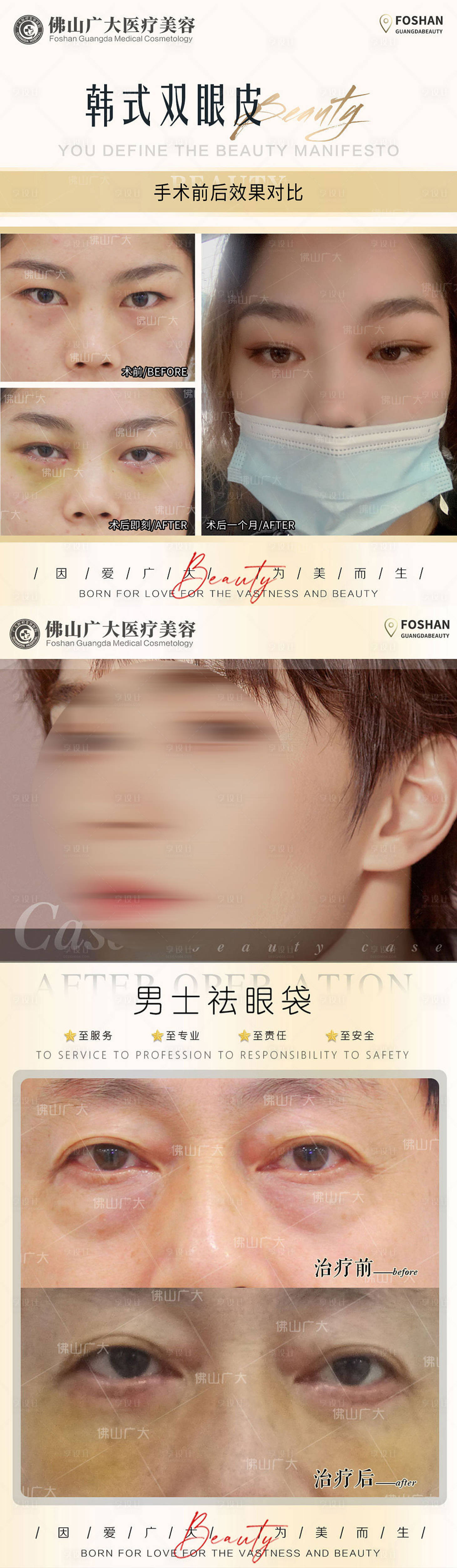 源文件下载【整形真人案例分享集】编号：65840009785033717