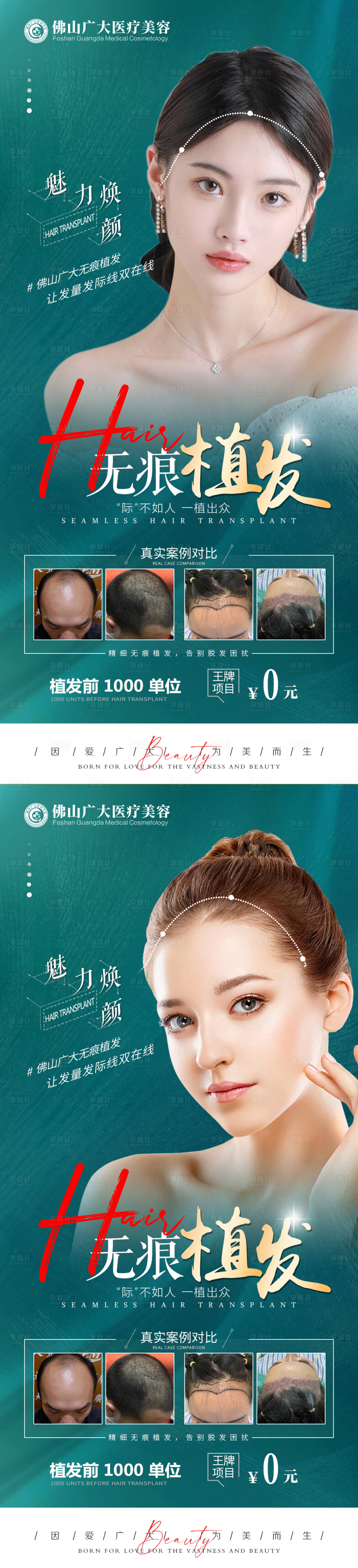 源文件下載【植發(fā)活動(dòng)案例長(zhǎng)圖海報(bào)】編號(hào)：18100009867805740