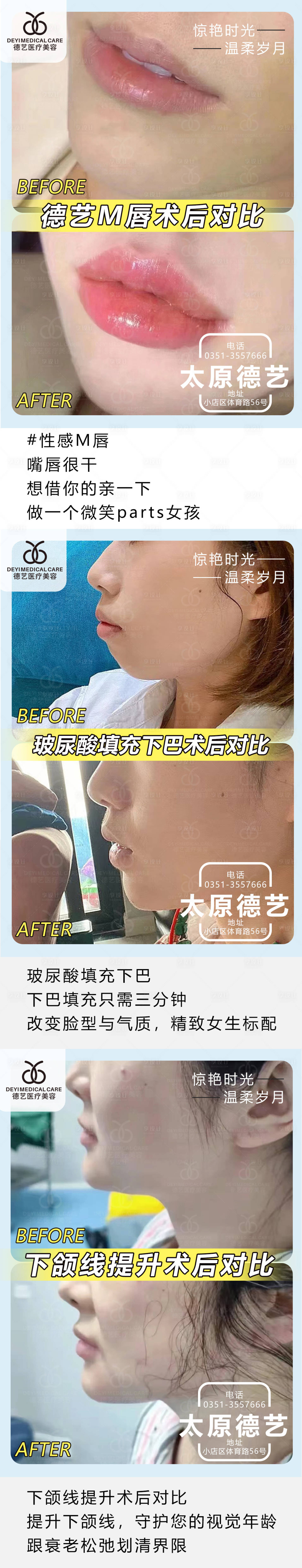源文件下載【享設計】搜索編號：78260010107007969【醫美案例對比圖】