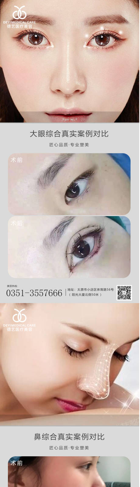 源文件下載【醫美案例對比圖】編號：81330010214287236