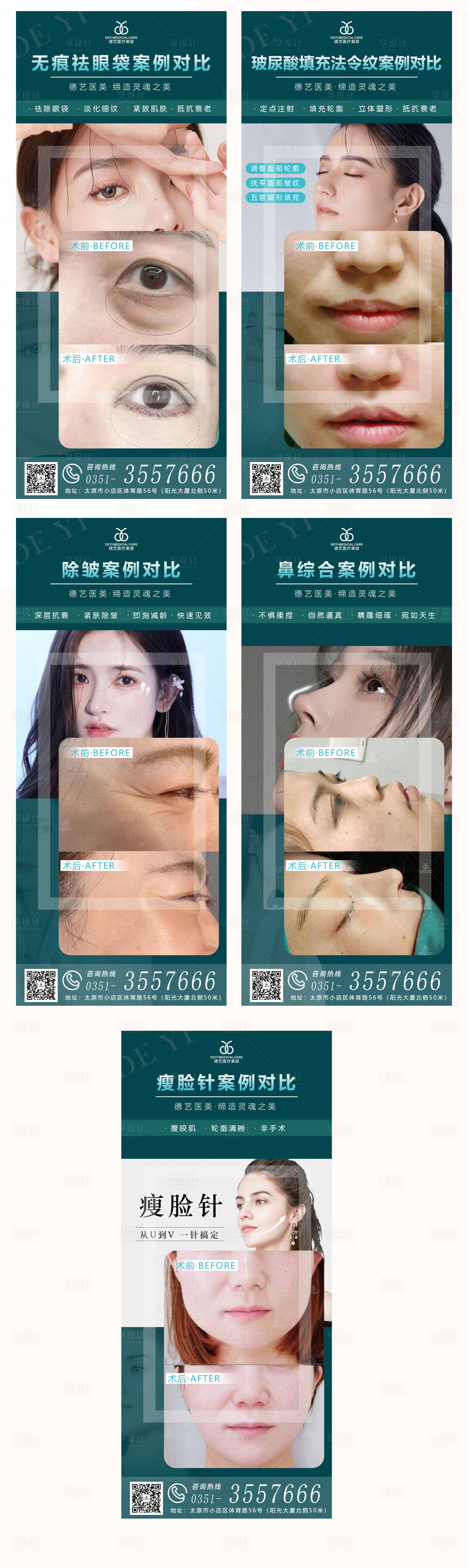 源文件下载【享设计】搜索编号：28990009827967862【医美案例对比图】