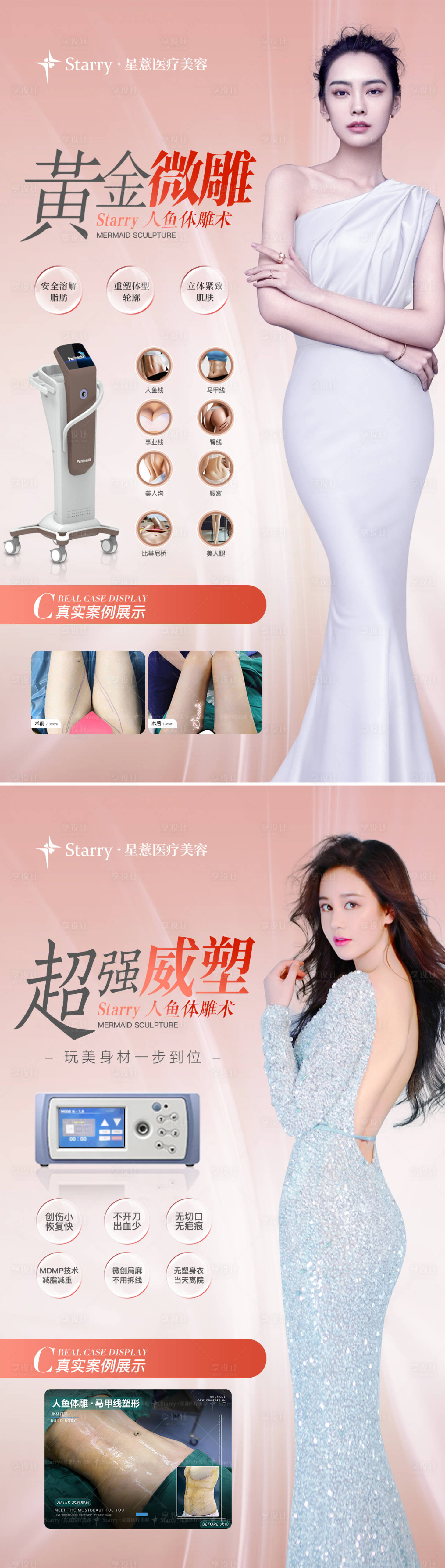 源文件下载【医美吸脂塑形海报】编号：71890010012943390