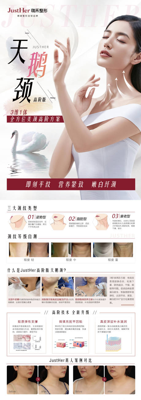 源文件下载【天鹅颈】编号：87360010241185201