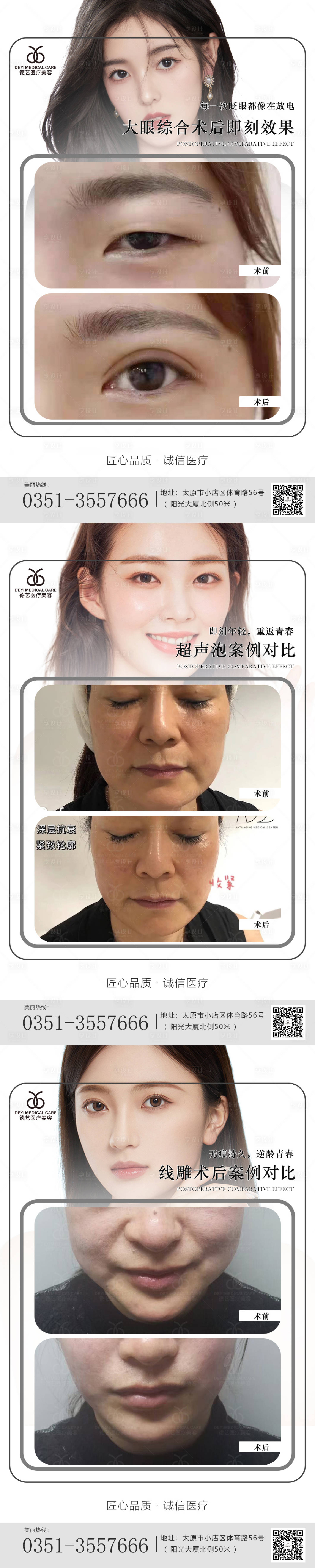 源文件下载【享设计】搜索编号：22360010237931771【医美案例对比系列海报】