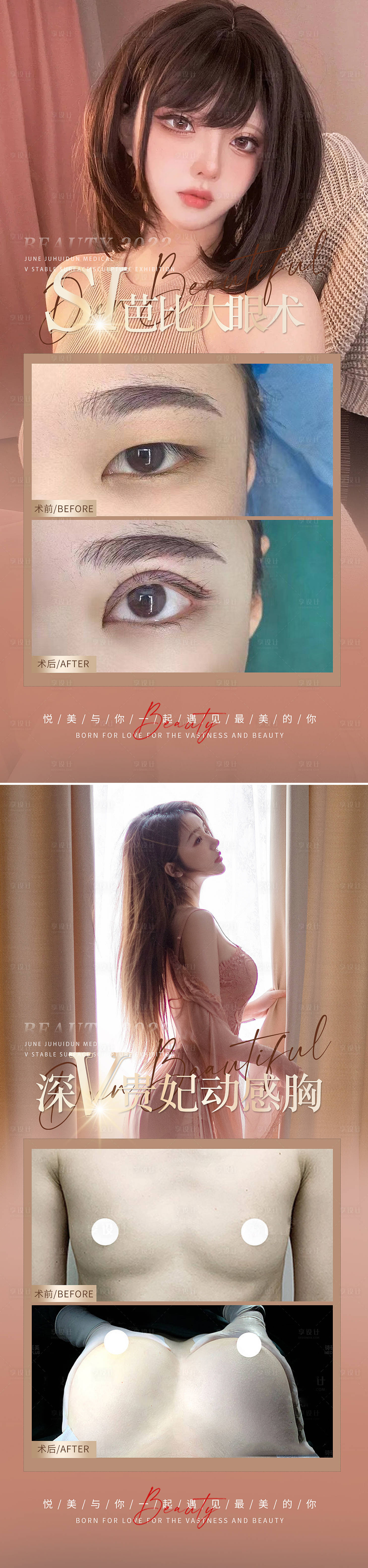 源文件下載【享設計】搜索編號：47210009980077961【醫美雙眼皮隆胸案例海報】