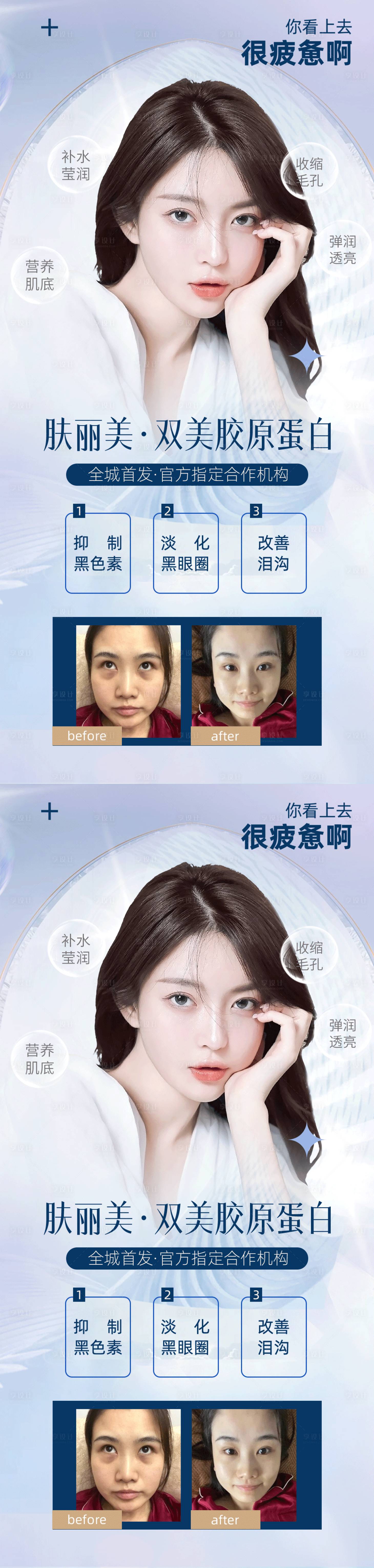 源文件下载【医美胶原蛋白系列海报】编号：28020010008807482
