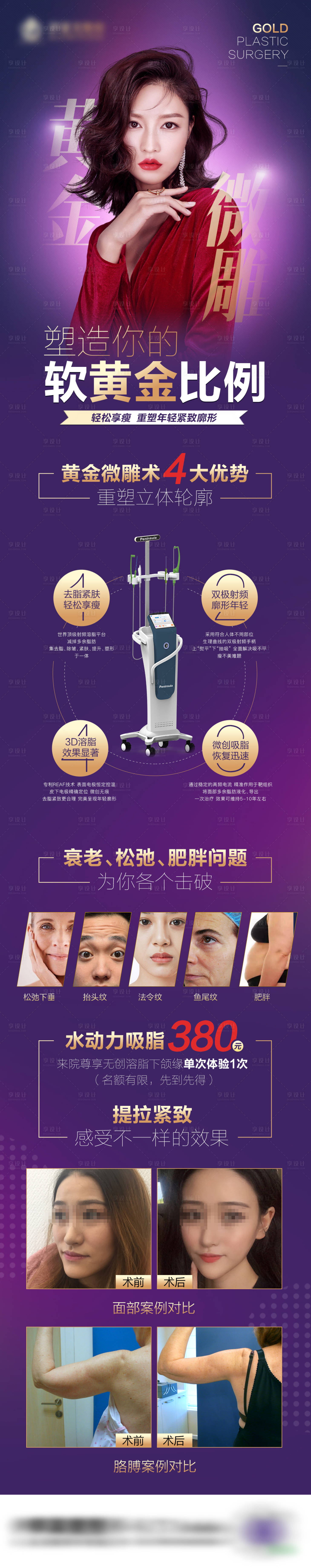 源文件下载【享设计】搜索编号：58290009766878420【医美仪器长图】