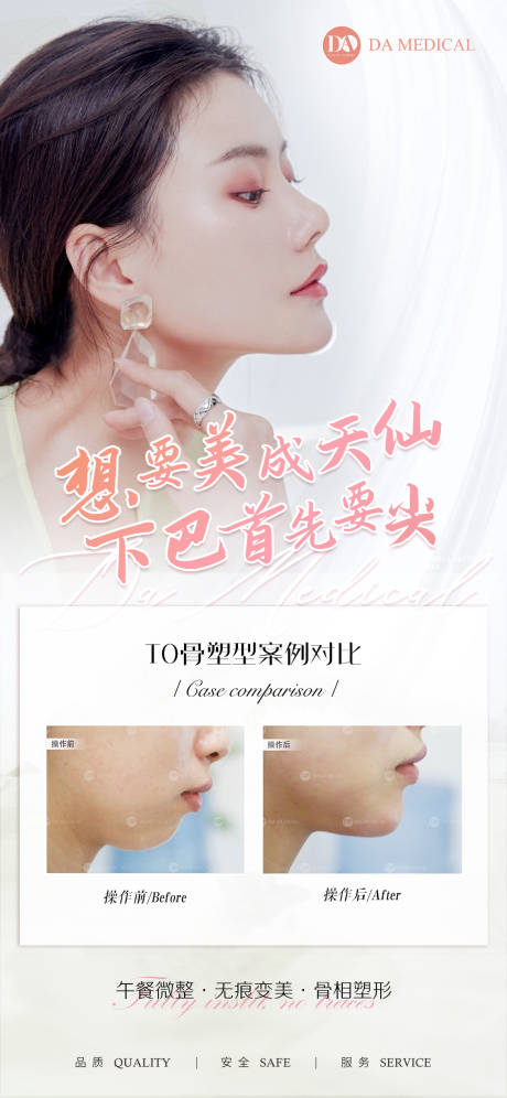 源文件下载【医美下巴海报】编号：59850010054021212