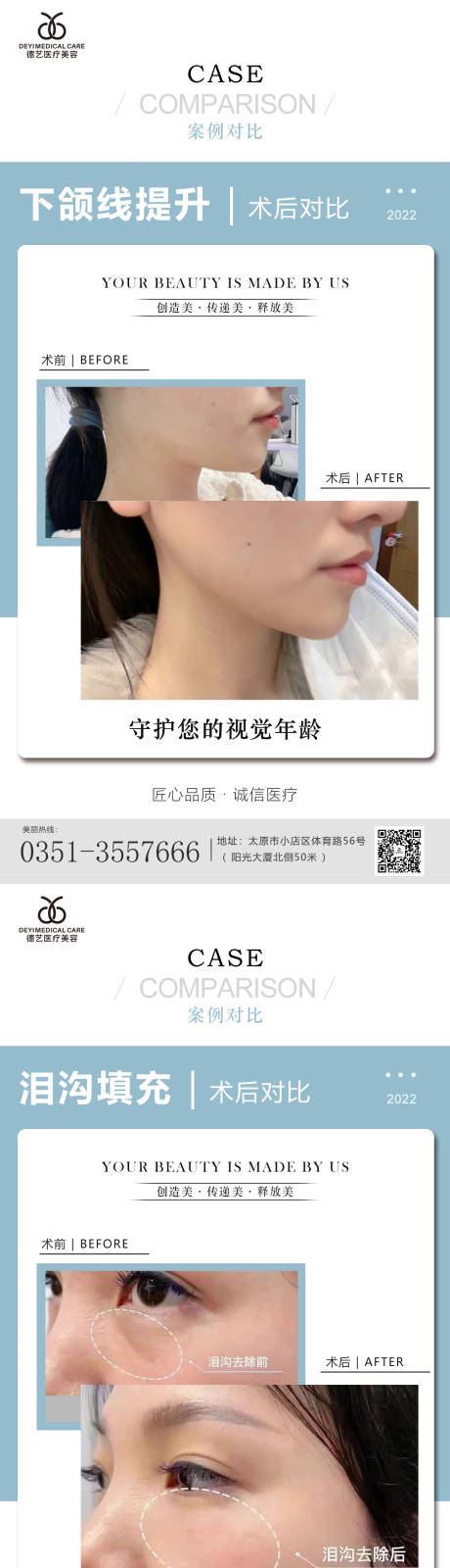 源文件下载【医美案例对比图】编号：31390010124444133