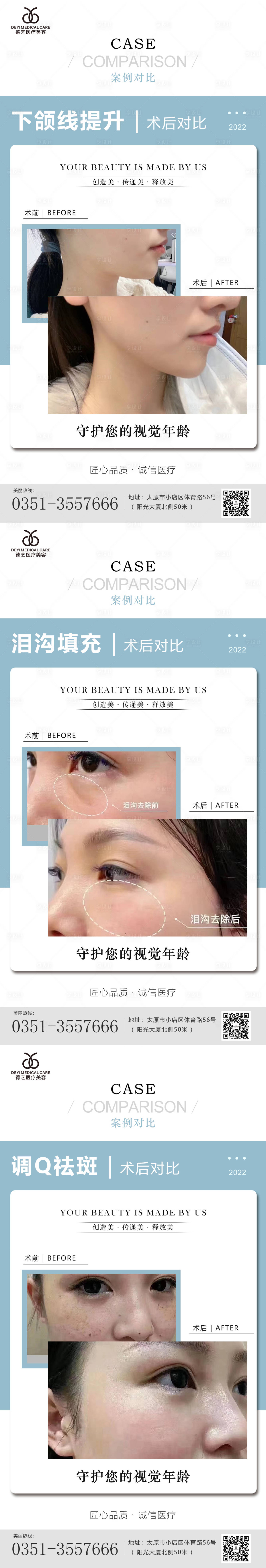源文件下載【醫美案例對比圖】編號：31390010124444133
