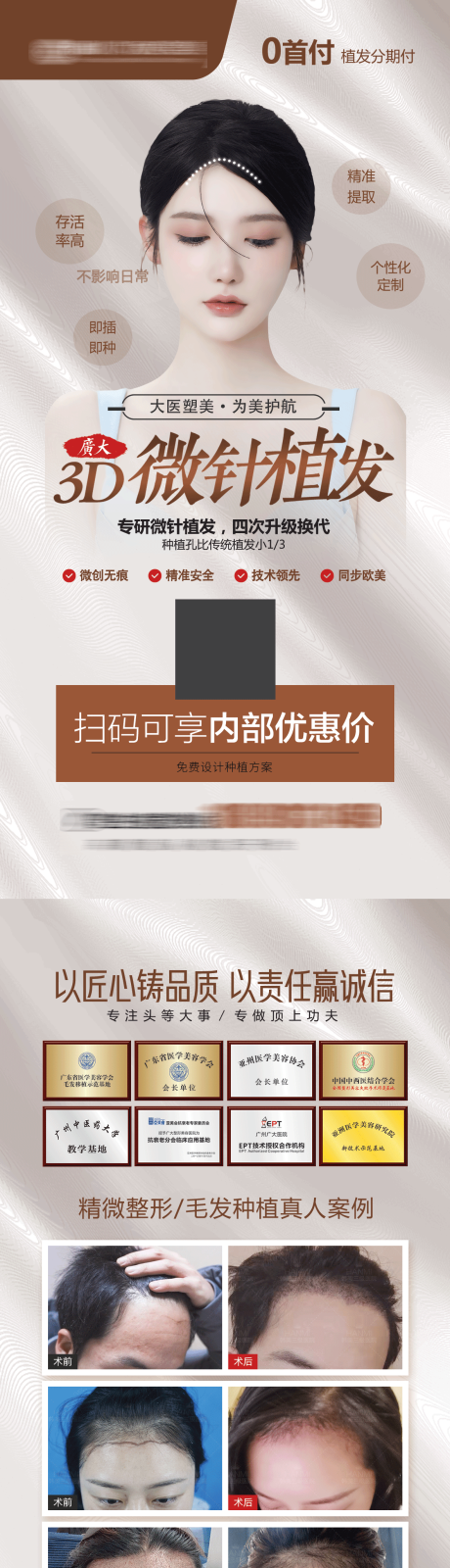 源文件下载【植发宣传单】编号：62390010293471024