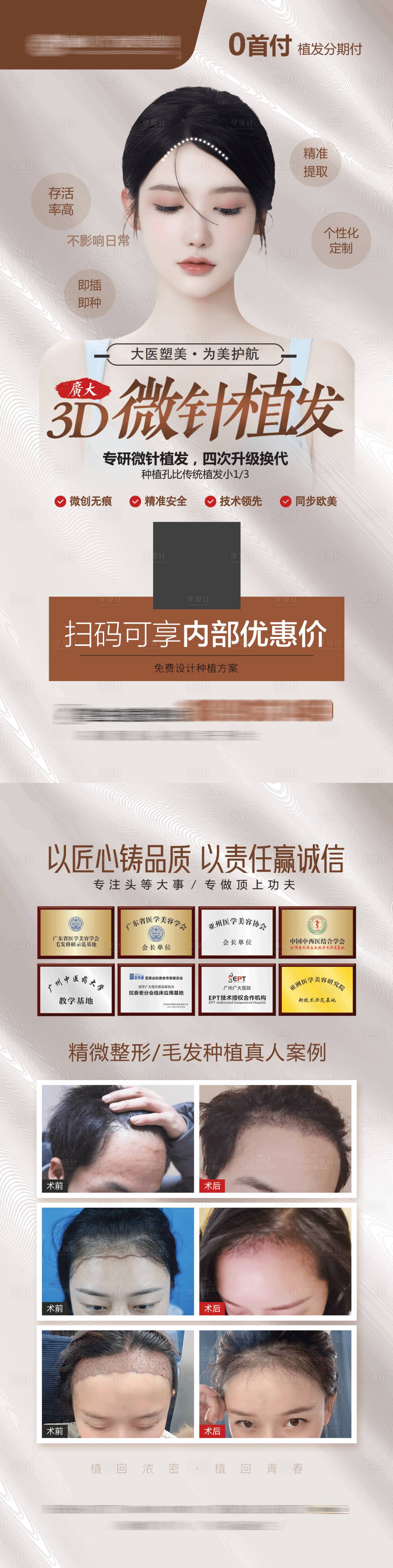 源文件下载【享设计】搜索编号：62390010293471024【植发宣传单】