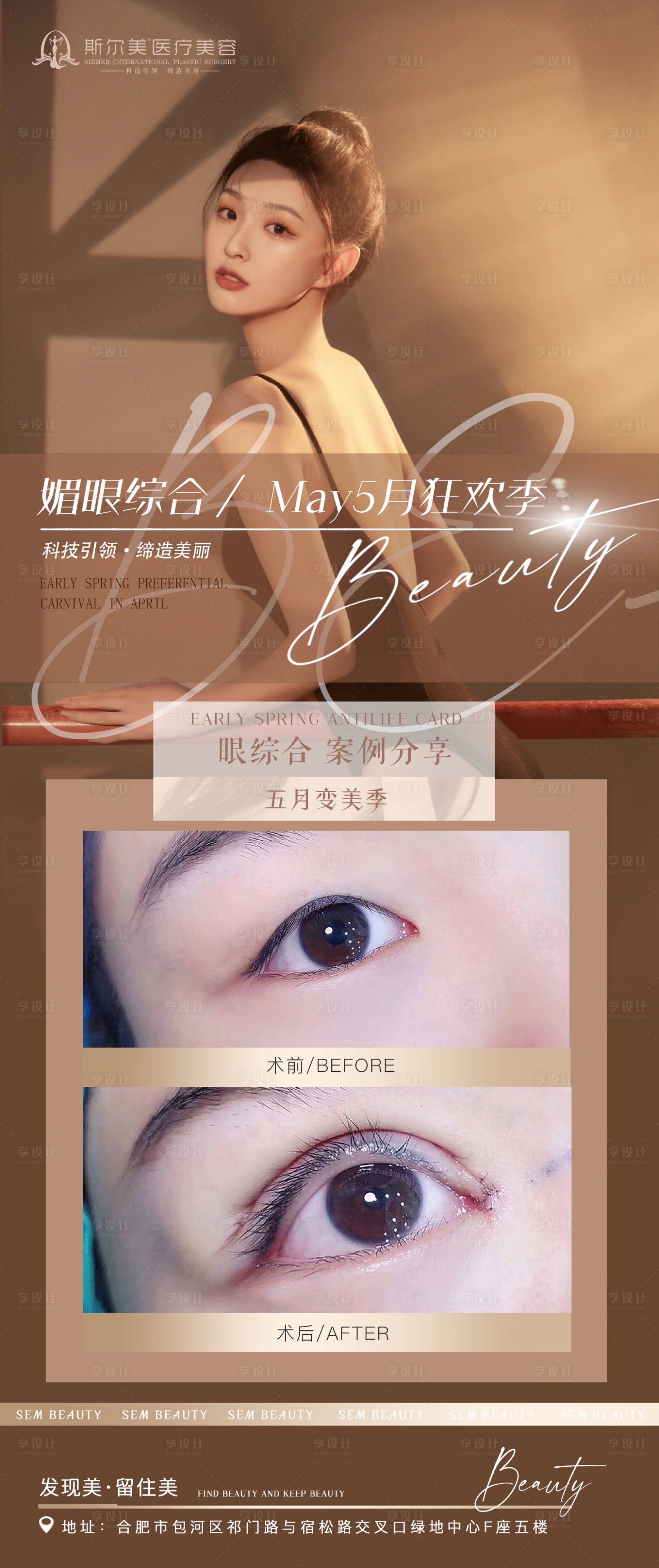源文件下载【享设计】搜索编号：82690009818551527【眼案例对比】