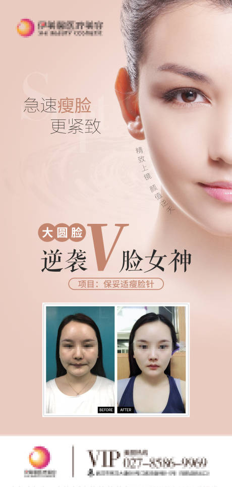源文件下载【医美瘦脸针v脸海报】编号：26650009839352774