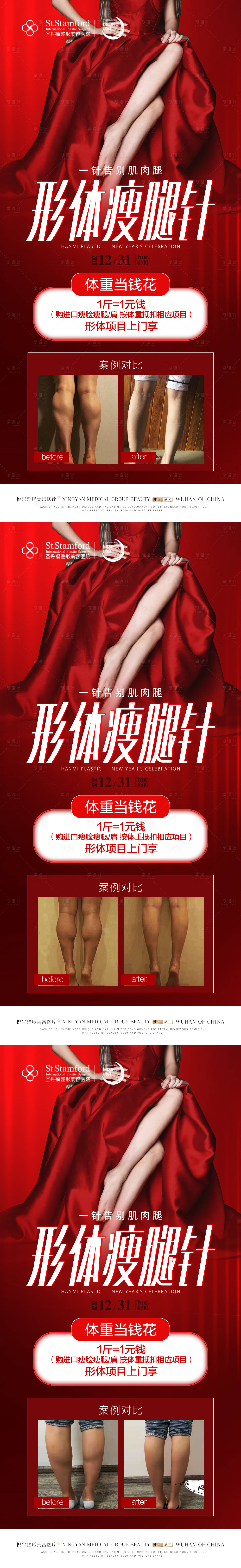 源文件下載【享設計】搜索編號：21850009974514767【形體瘦腿針醫美海報】