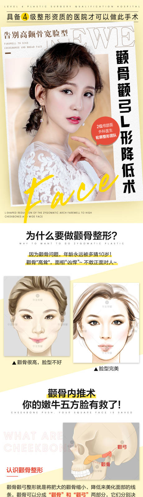 源文件下载【颧骨颧弓L形降低术】编号：82030010273206448