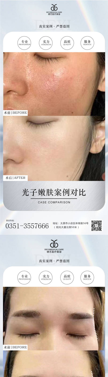 源文件下載【享設(shè)計(jì)】搜索編號(hào)：99460010035693745【醫(yī)美案例對(duì)比圖】
