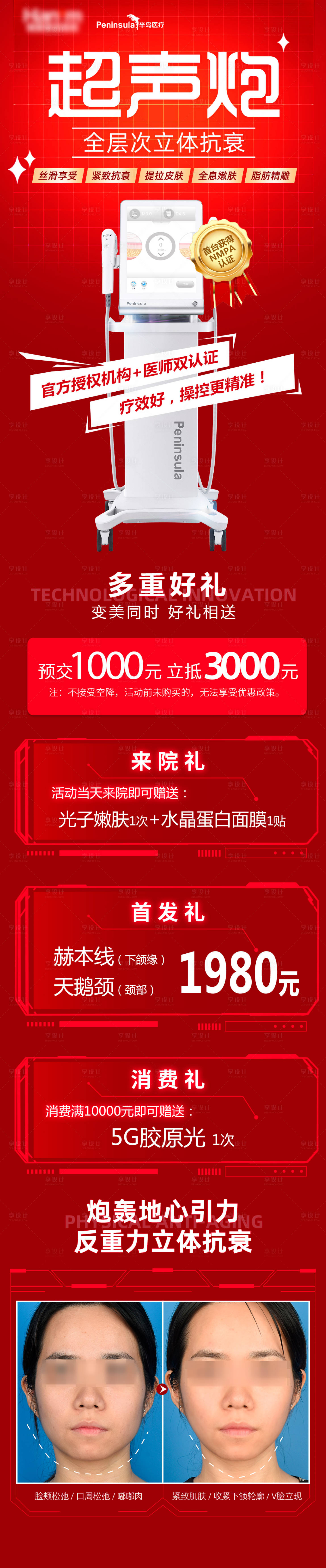源文件下载【享设计】搜索编号：90280010261559893【超声炮 】