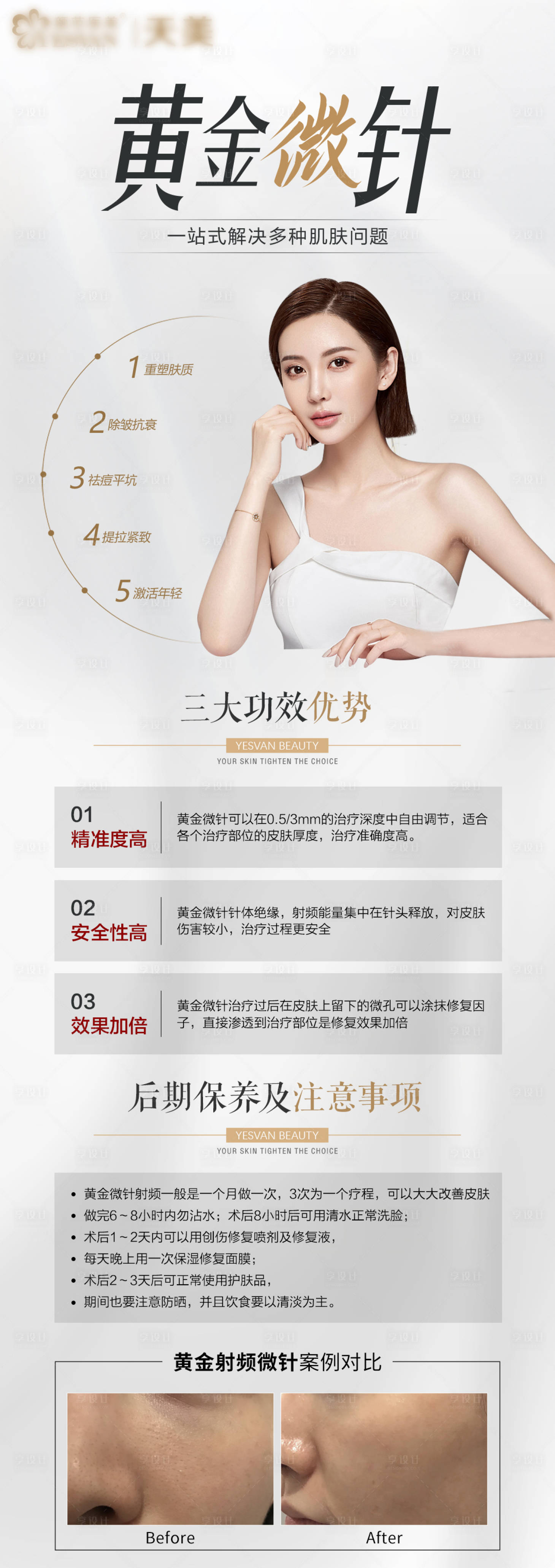 源文件下載【享設(shè)計】搜索編號：47090010084736000【黃金微針優(yōu)勢】