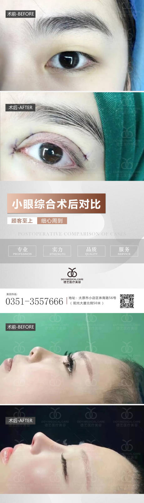 源文件下载【享设计】搜索编号：35120010304281220【医美案例对比系列海报】