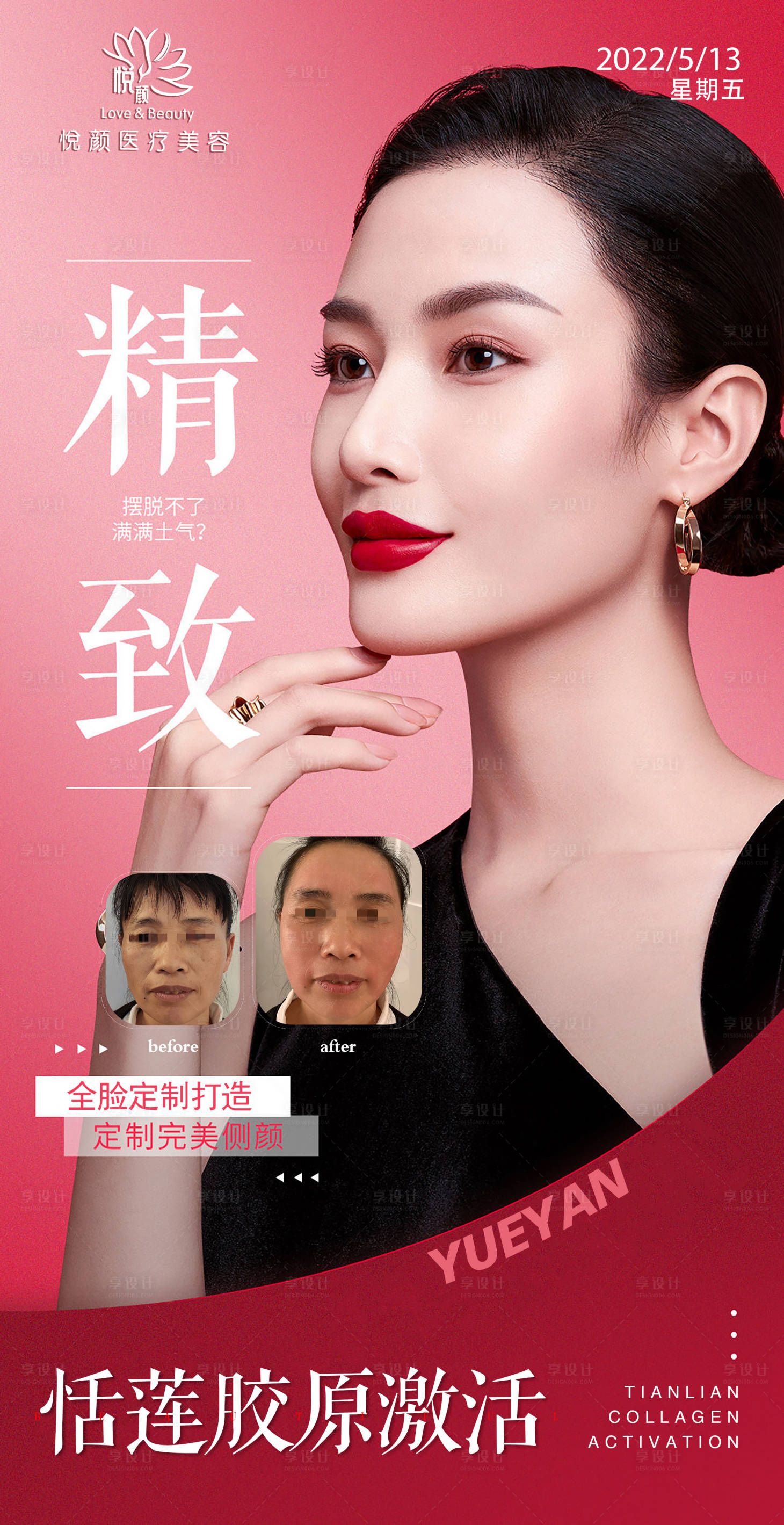 源文件下载【享设计】搜索编号：92330010094672032【医美项目促销海报】