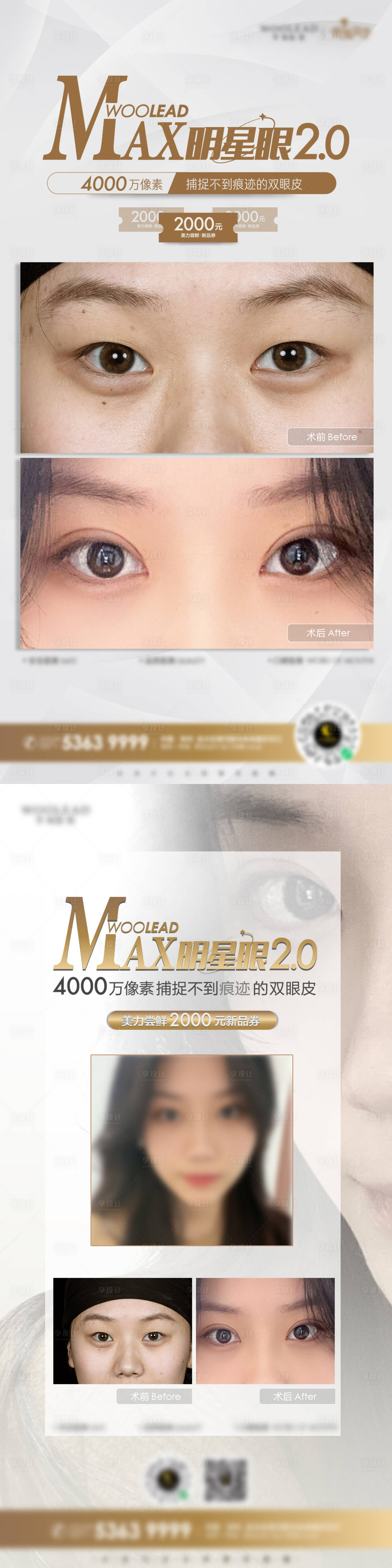 源文件下載【享設計】搜索編號：79570010263538173【醫美雙眼皮海報】