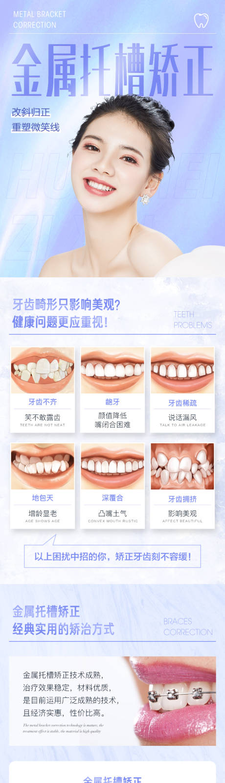源文件下载【金属托槽矫正电商详情页】编号：22740010065421310