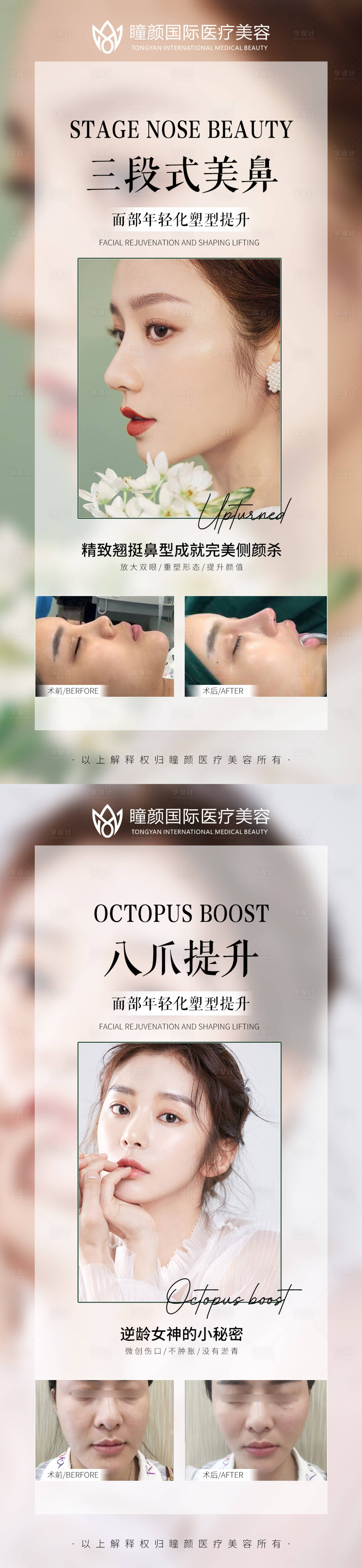 源文件下载【享设计】搜索编号：99580009800916771【医美案例对比系列海报】